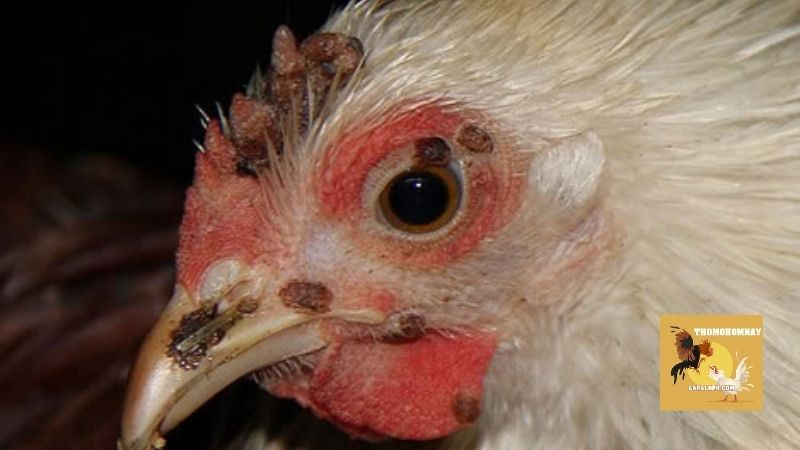 Một vài dấu hiệu nhận biết sớm của căn bệnh đậu gà